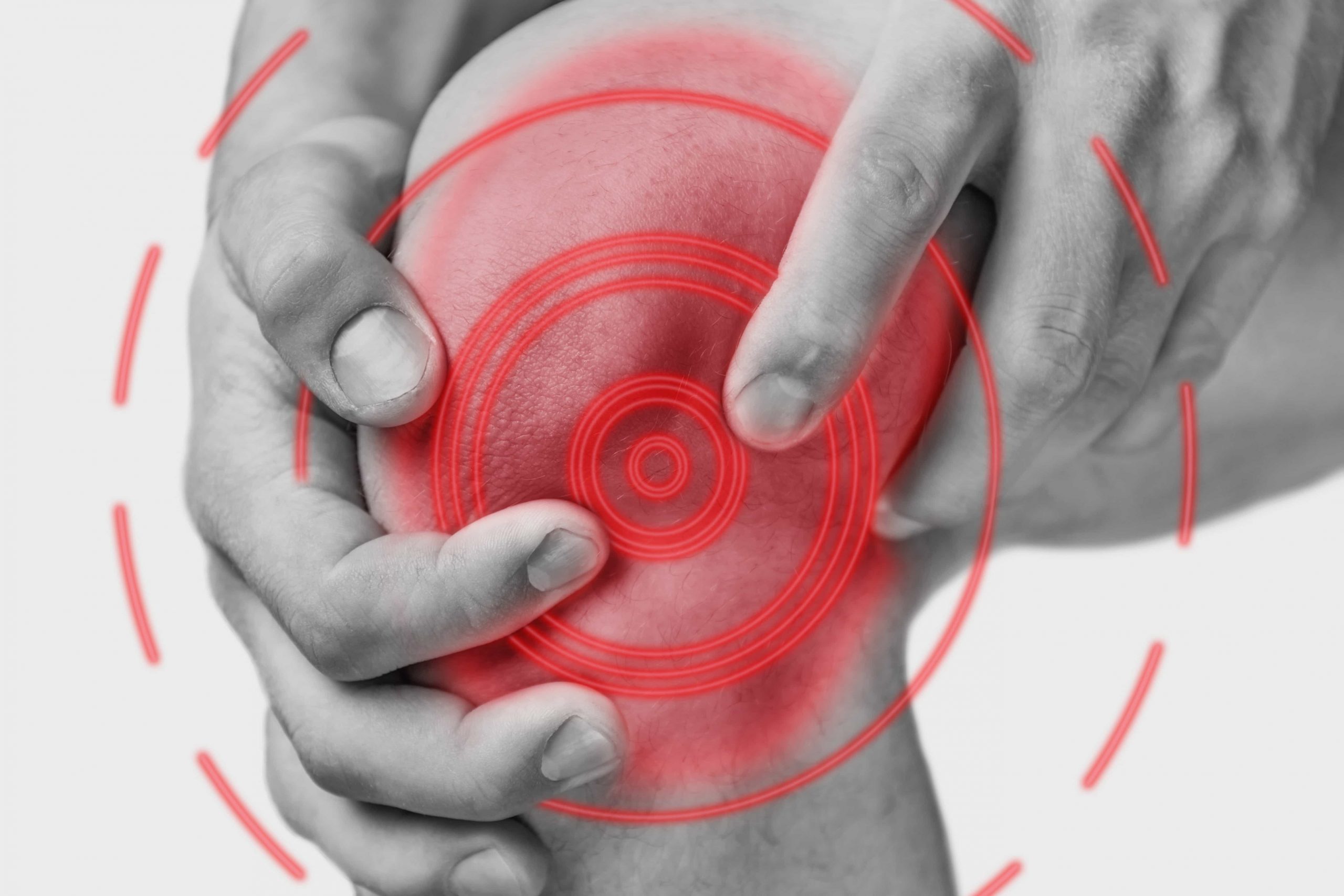 IL GINOCCHIO FA MALE ECCO ALCUNE CONSIDERAZIONI DELL'OSTEOPATA